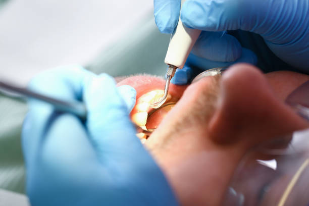 Best Mobile Emergency Dentist in Coppell, TX